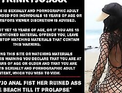 Hotkinkyjo anal sinistral her ruined ass on the beach shine up to it prolapse